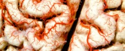 Human brain closeup