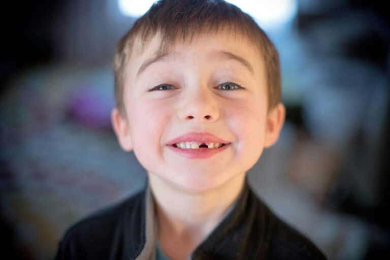 Google Ads változás: általános egyezés alapértelmezetten Lost tooth