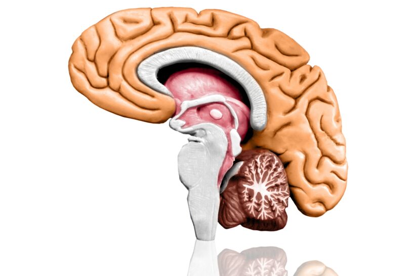Brain model