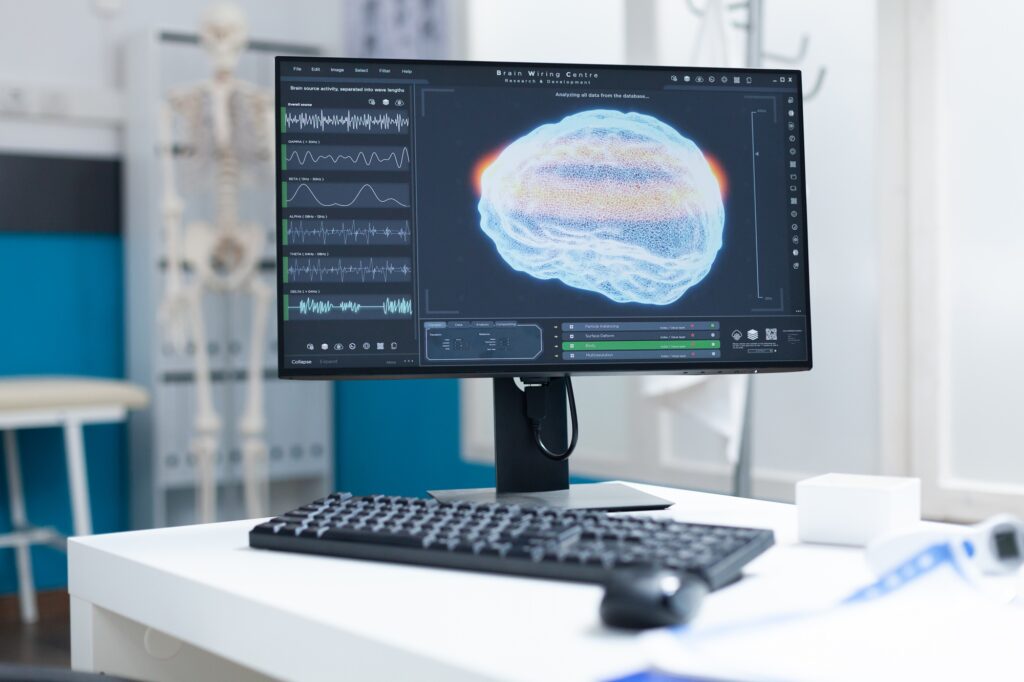 Computer with brain ct scan on screen standing on table in empty doctors office